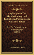 Angle's System Zur Geraderichtung Und Festhaltung, Unregalmassig Gestellter Zahne: Und Zur Behandlung Von Kieferbruchen (1904)