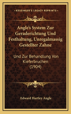 Angle's System Zur Geraderichtung Und Festhaltung, Unregalmassig Gestellter Zahne: Und Zur Behandlung Von Kieferbruchen (1904) - Angle, Edward Hartley