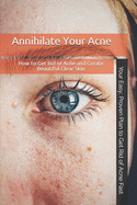 Annihilate Your Acne: How to Get Rid of Acne and Create Beautiful, Clear Skin; Your Easy, Proven Plan to Get Rid of Acne Fast