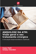 Anquilose Da ATM: Vis?o geral e seu tratamento cirrgico