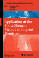 Application of the Finite Element Method in Implant Dentistry