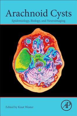 Arachnoid Cysts: Epidemiology, Biology, and Neuroimaging - Wester, Knut (Editor)