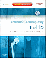 Arthritis and Arthroplasty: The Hip: Expert Consult - Online, Print and DVD