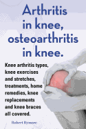 Arthritis in Knee, Osteoarthritis in Knee. Knee Arthritis Types, Knee Exercises and Stretches, Treatments, Home Remedies, Knee Replacements and Knee Braces All Covered.
