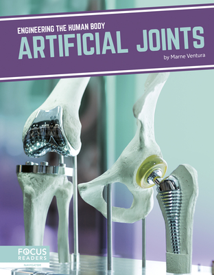 Artificial Joints - Ventura, Marne