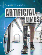 Artificial Limbs