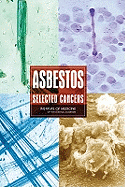 Asbestos: Selected Cancers - Institute of Medicine, and Board on Population Health and Public Health Practices, and Committee on Asbestos Selected Health...
