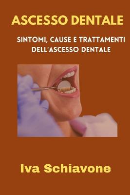Ascesso Dentale: Sintomi, Cause E Trattamenti Dell'ascesso Dentale - Schiavone, Iva