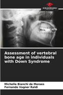 Assessment of vertebral bone age in individuals with Down Syndrome