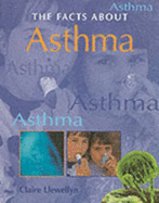 Asthma