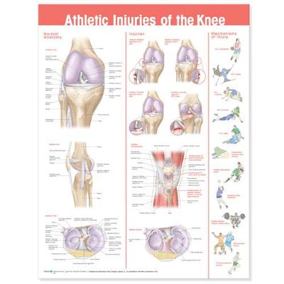 Athletic Injuries of the Knee Anatomical Chart - Acc, and Anatomical Chart Company (Editor)