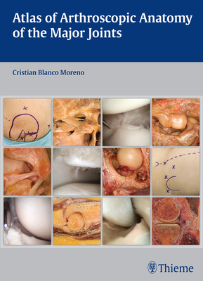 Atlas of Arthroscopic Anatomy of the Major Joints - Blanco Moreno, Cristian