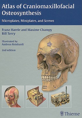 Atlas of Craniomaxillofacial Osteosynthesis: Microplates, Miniplates, and Screws - Hrle, Franz, and Champy, Maxime, and Terry, Bill
