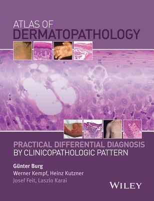 Atlas of Dermatopathology: Practical Differential Diagnosis by Clinicopathologic Pattern - Burg, Gnter (Editor), and Kempf, Werner (Editor), and Kutzner, Heinz (Editor)