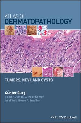 Atlas of Dermatopathology: Tumors, Nevi, and Cysts - Burg, Gnter, and Kutzner, Heinz, and Kempf, Werner