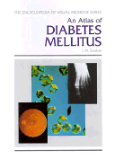 Atlas of Diabetes Mellitus