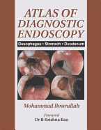 Atlas of Diagnostic Endoscopy: Oesophagus, Stomach, Duodenum - Ibrarullah, Mohammad