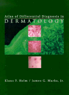 Atlas of Differential Diagnosis in Dermatology - Marks, James G, MD, and Helm, Klaus F, MD