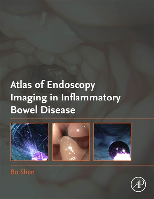 Atlas of Endoscopy Imaging in Inflammatory Bowel Disease - Shen, Bo (Editor)