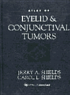 Atlas of Eyelid and Conjunctival - Shields, Jerry A, Dr., MD, and Shields, Carol L, Dr., MD, and Shields, Murrell G