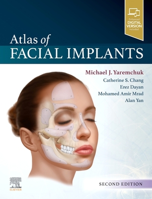 Atlas of Facial Implants - Yaremchuk, Michael J.