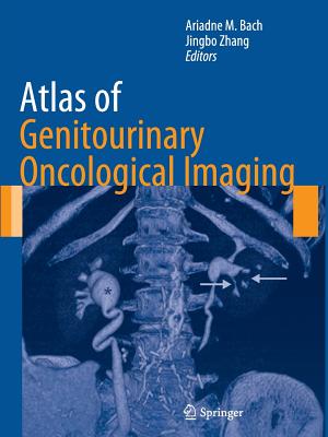 Atlas of Genitourinary Oncological Imaging - Bach, Ariadne M (Editor), and Zhang, Jingbo (Editor)