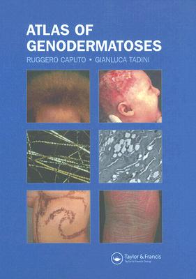 Atlas of Genodermatoses - Caputo, Ruggero, and Tadini, Gianluca
