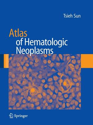 Atlas of Hematologic Neoplasms - Sun, Tsieh