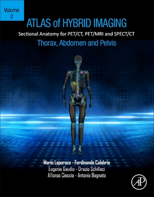 Atlas of Hybrid Imaging Sectional Anatomy for Pet/Ct, Pet/MRI and Spect/CT Vol. 2: Thorax Abdomen and Pelvis: Sectional Anatomy for Pet/Ct, Pet/MRI and Spect/CT - Leporace, Mario, and Calabria, Ferdinando, and Gaudio, Eugenio