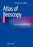 Atlas of Ileoscopy: A Collection of Clinical Cases