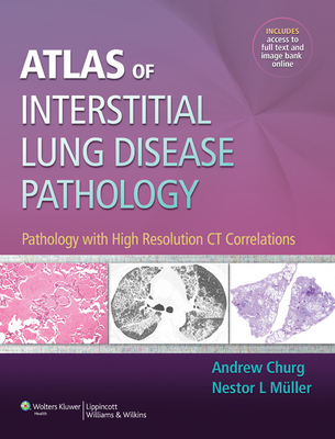 Atlas of Interstitial Lung Disease Pathology: Pathology with High Resolution CT Correlations - Churg, Andrew, MD