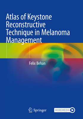Atlas of Keystone Reconstructive Technique in Melanoma Management - Behan, Felix