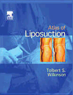 Atlas of Liposuction