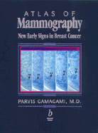 Atlas of Mammography