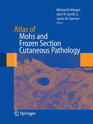 Atlas of Mohs and Frozen Section Cutaneous Pathology - Morgan, Michael (Editor), and Hamill, John R (Editor), and Spencer, James M (Editor)