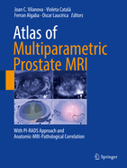 Atlas of Multiparametric Prostate MRI: With Pi-Rads Approach and Anatomic-Mri-Pathological Correlation