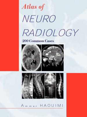 Atlas of Neuroradiology: 200 Common Cases - Haouimi, Ammar