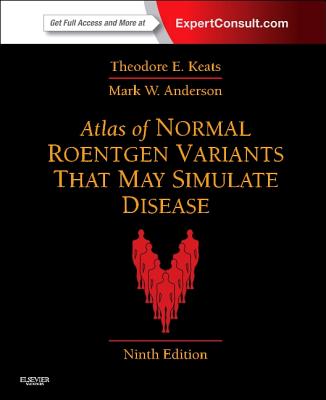Atlas of Normal Roentgen Variants That May Simulate Disease: Expert Consult - Enhanced Online Features and Print - Keats, Theodore E, MD, and Anderson, Mark W, MD
