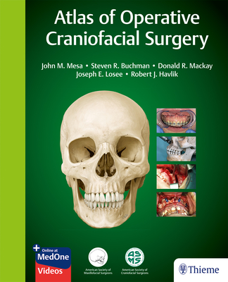 Atlas of Operative Craniofacial Surgery - Mesa, John (Editor), and Buchman, Steven R (Editor), and MacKay, Donald R (Editor)