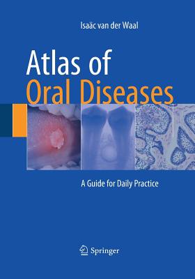Atlas of Oral Diseases: A Guide for Daily Practice - Van Der Waal, Isac