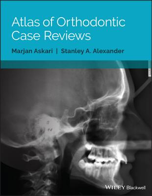 Atlas of Orthodontic Case Reviews - Askari, Marjan, and Alexander, Stanley A.