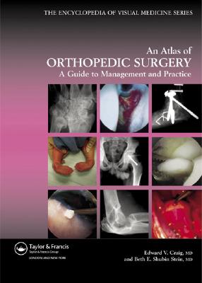 Atlas of Orthopedic Surgery - Craig, Edward Vincent, MD, and Shubin Stein, Beth E