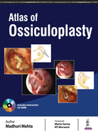 Atlas of Ossiculoplasty