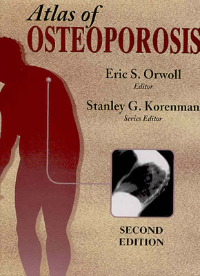 Atlas of Osteoporosis - Korenman, Stanley G (Editor)