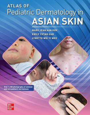 Atlas of Pediatric Dermatology in Asian Skin - Koh, Mark Jean Aan, and Gan, Emily Yiping, and Wee, Lynette Wie Yi