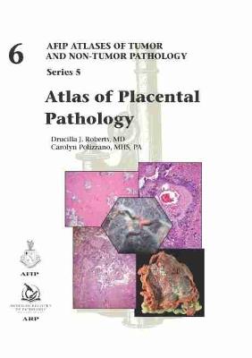 Atlas of Placental Pathology - Roberts, Drucilla J., and Polizzano, Carolyn