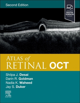 Atlas of Retinal Oct: Optical Coherence Tomography - Duker, Jay S, MD (Editor), and Waheed, Nadia K, MD, MPH (Editor), and Goldman, Darin, MD (Editor)