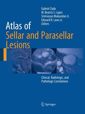Atlas of Sellar and Parasellar Lesions: Clinical, Radiologic, and Pathologic Correlations - Zada, Gabriel (Editor), and Lopes, M Beatriz S (Editor), and Mukundan Jr, Srinivasan (Editor)