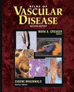 Atlas of Vascular Disease - Creager, Mark A (Editor), and Braunwald, Eugene, MD, Frcp (Editor)