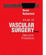 Atlas of Vascular Surgery: Operative Procedures